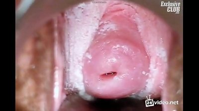 妇科检查的美女